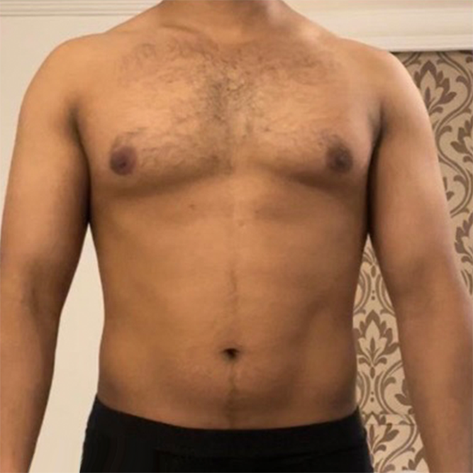 Before transformation