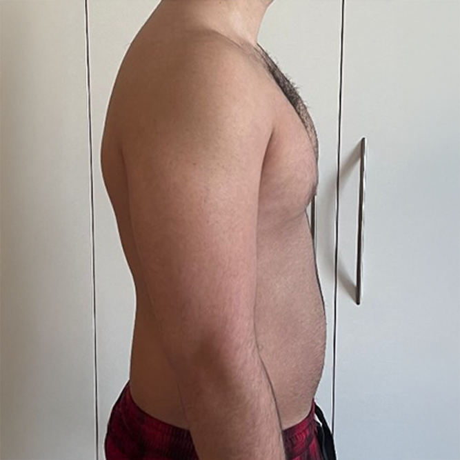 Before transformation