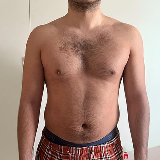 Before transformation